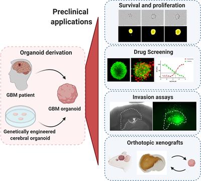 Glioblastoma Organoids: Pre-Clinical Applications and Challenges in the Context of Immunotherapy